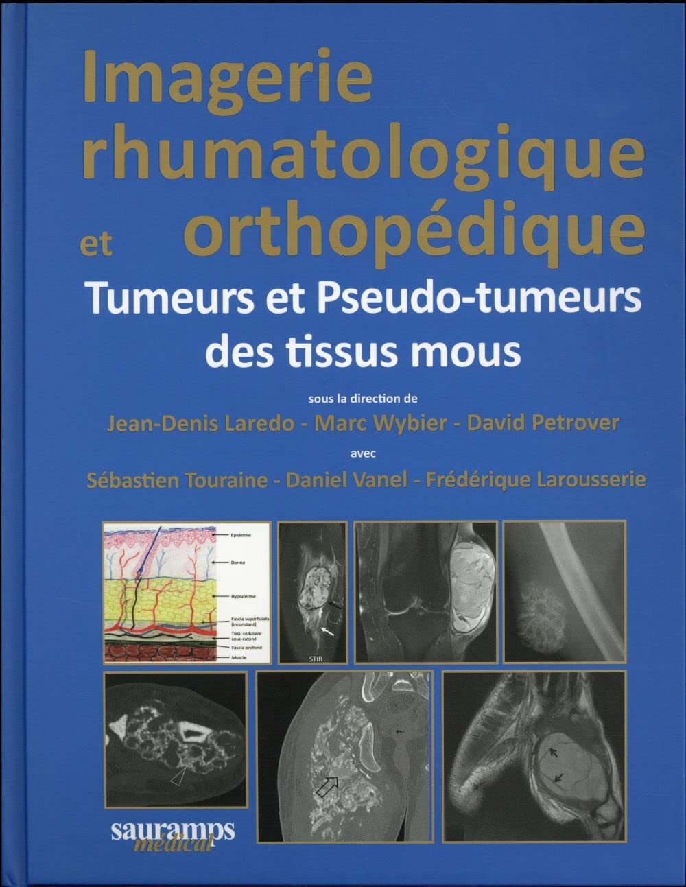 IMAGERIE RHUMATOLOGIQUE ET ORTHOPEDIQUE TOME 5 -TUMEURS ET PSEUDO-TUMEURS DES TI book