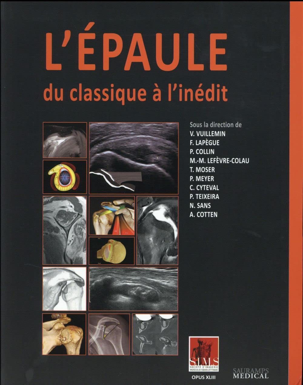 L'épaule, Du Classique À L'inédit: l'articulation scapulothoracique, les articulations acromioclaviculaire, sternoclaviculaires et scapulohumérale, les muscles... Medicine