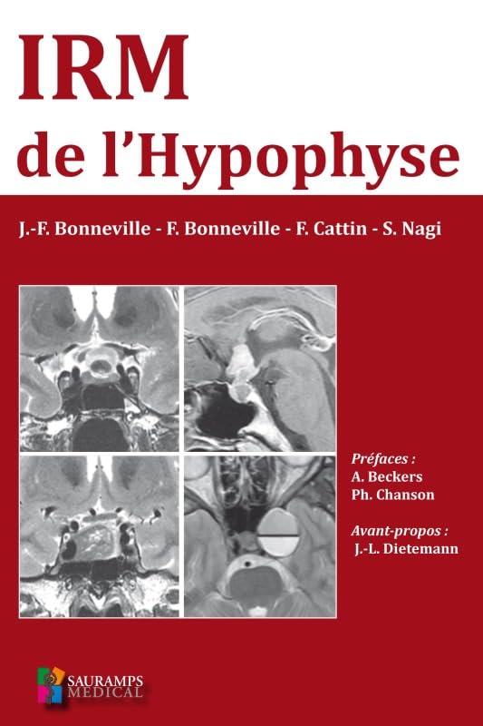 IRM DE L HYPOPHYSE Medicine
