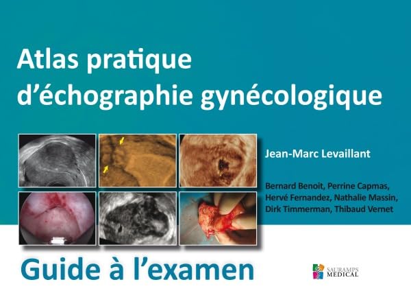 ATLAS PRATIQUE D ECHOGRAPHIE GYNECOLOGIQUE- GUIDE A L EXAMEN: Guide à l'examen Medicine