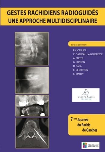 GESTES RACHIDIENS RADIOGUIDES-UNE APPROCHE Medicine