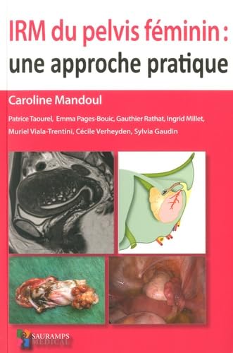 Irm Du Pelvis Féminin: Une Approche Pratique Medicine