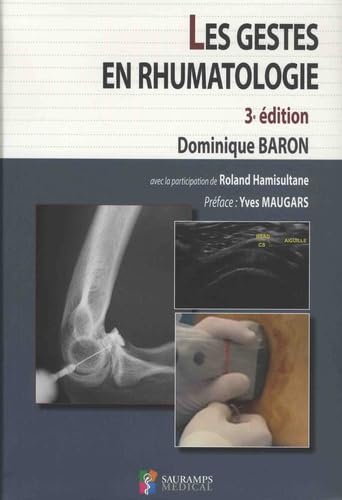 Les Gestes En Rhumatologie Medicine