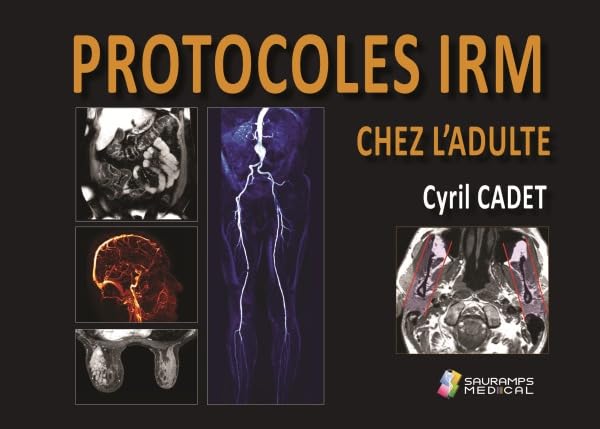 PROTOCOLES IRM CHEZ L ADULTE book
