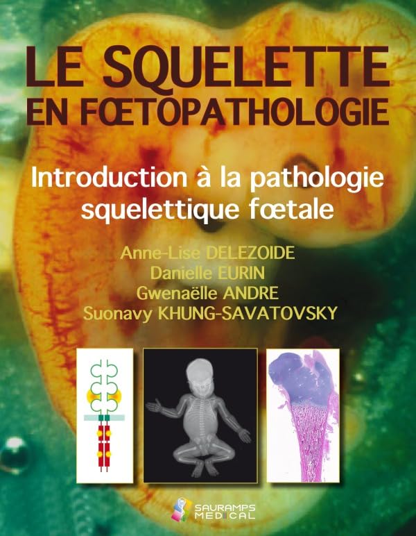 LE SQUELETTE EN FOETOPATHOLOGIE. INTR.A LA PATHOLOGIE SQUELETTIQUE FOETALE Medicine
