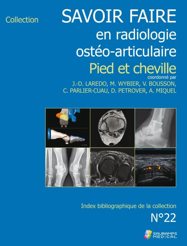 Savoir-faire en osteo-articulaire t 22 - pied et cheville Medicine