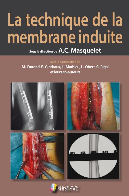 LA TECHNIQUE DE LA MEMBRANE INDUITE book