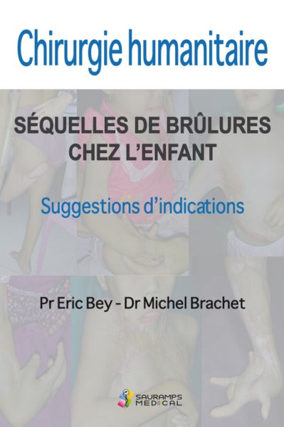 Chirurgie humanitaire : séquelles de brûlures chez l'enfant, suggestions d'indications : 20 ans d'expérience en Asie du Sud-Est aux côtés de la fondation Children Action. Humanitarian surgery, burn sequelae in children : suggestions for indications : a... book