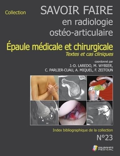 SAVOIR-FAIRE EN RADIOL OSTEO-ARTICUL N°23 EPAULE MEDICALE ET CHIRURGICALE: TEXTES ET CAS CLINIQUES book