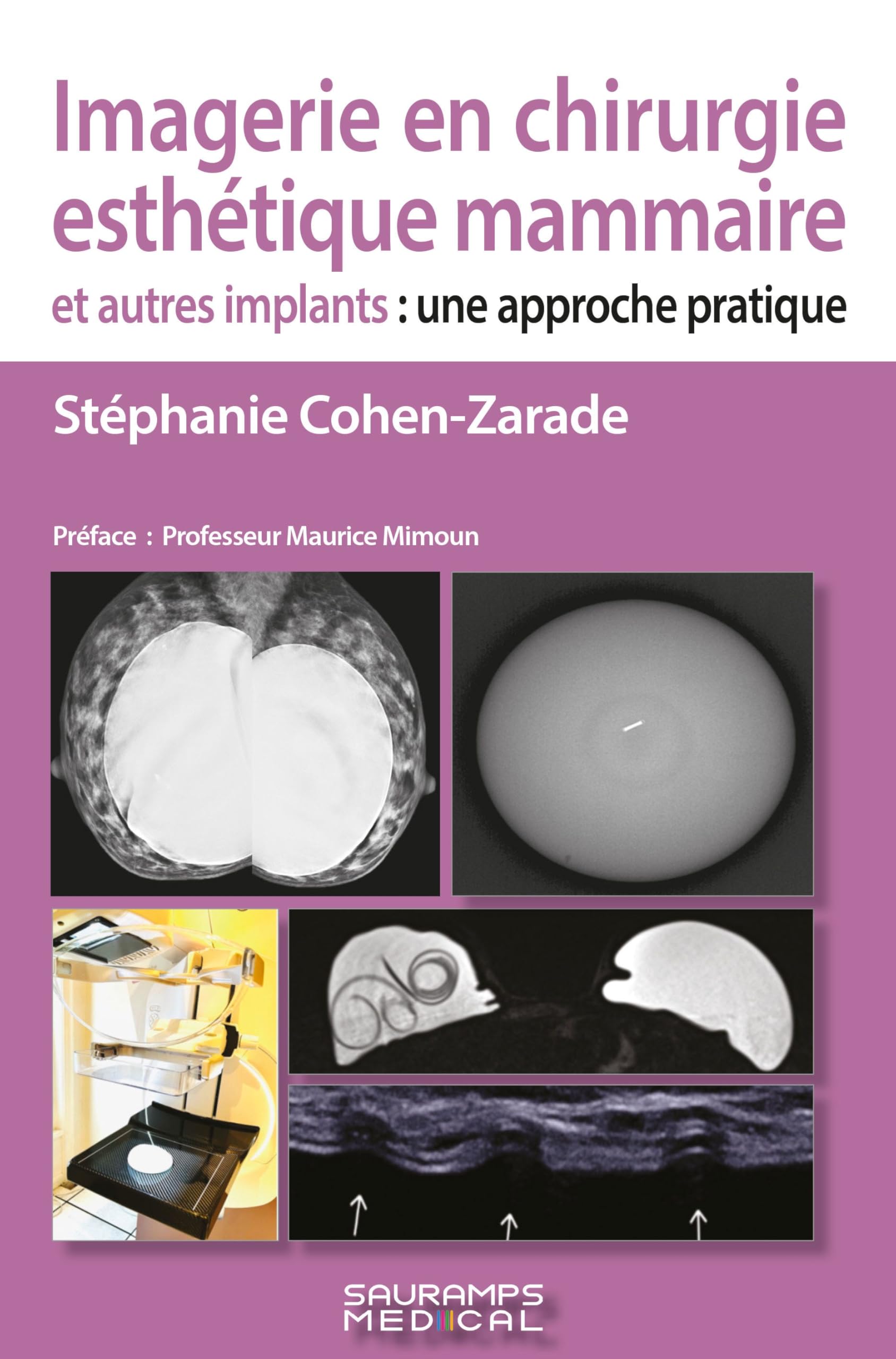 Imagerie en chirurgie esthétique mammaire et autres implants: APPROCHE PRATIQUE book