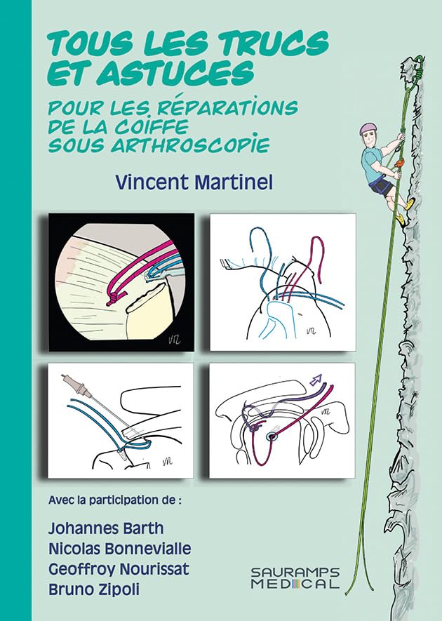 TOUS LES TRUCS ET ASTUCES POUR LES REPARATIONS DE LA COIFFE SOUS ARTHROSCOPIE book