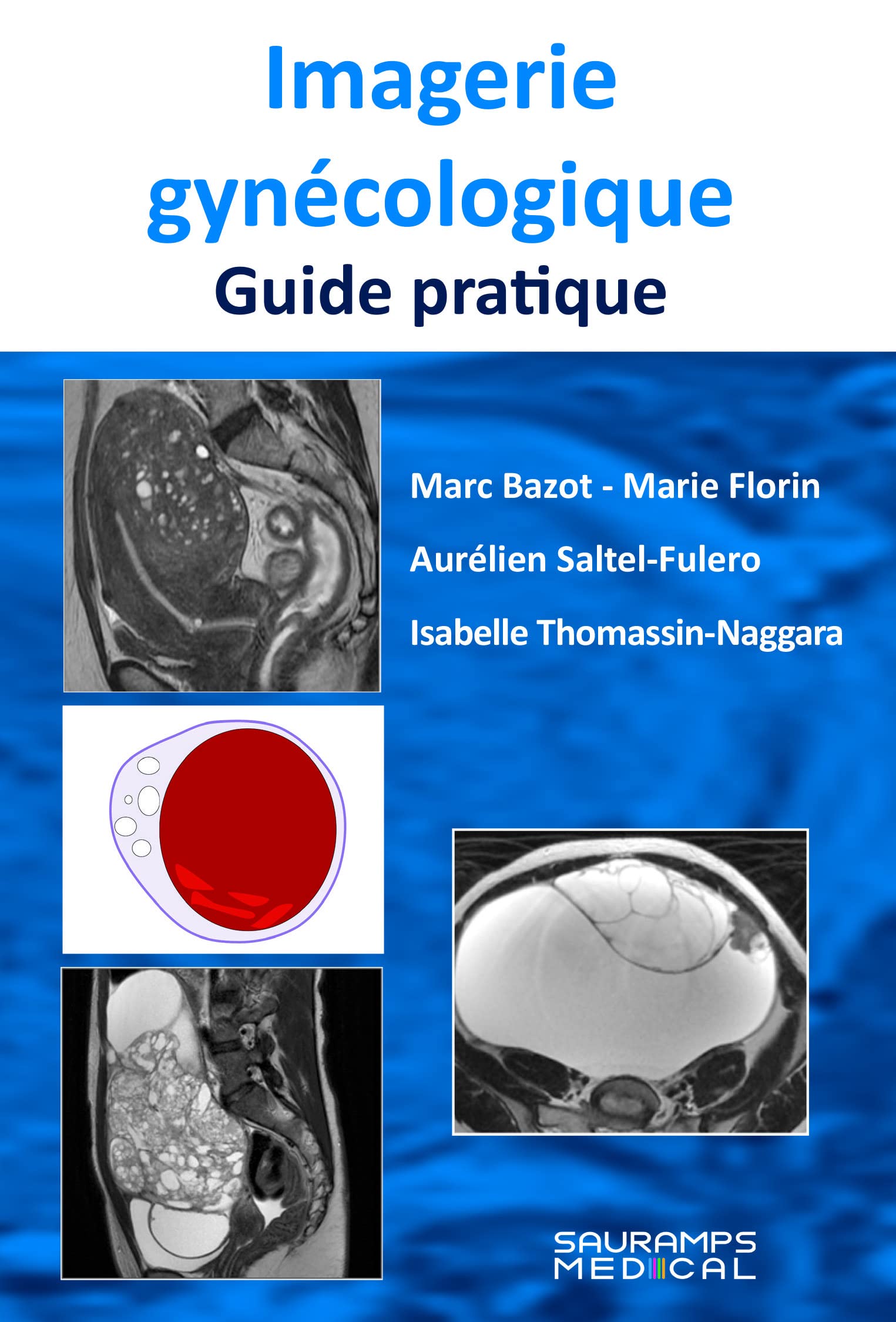 IMAGERIE GYNECOLOGIQUE: Guide pratique book