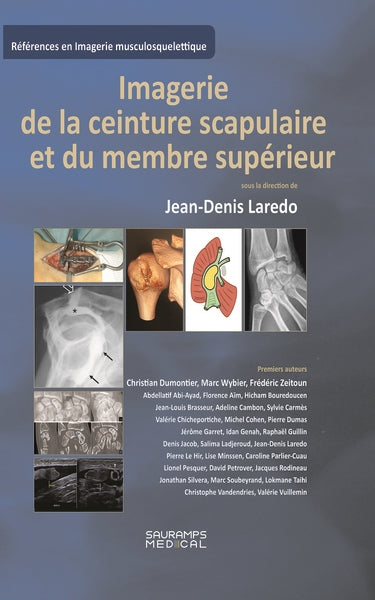 Imagerie de la ceinture scapulaire et du membre supérieur book