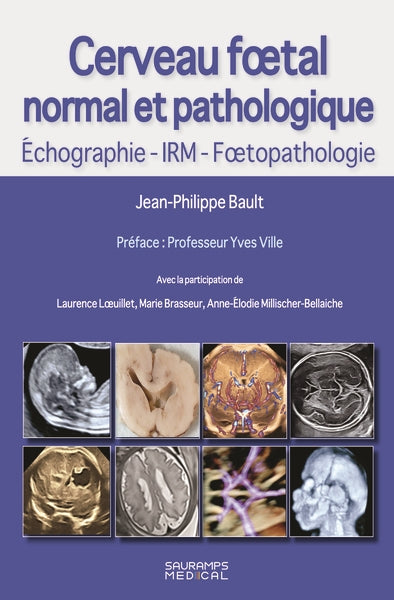 Cerveau foetal normal et pathologique : échographie, IRM, foetopathologie Medicine