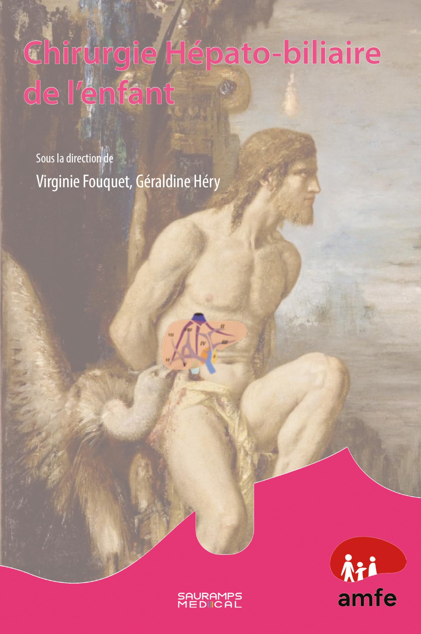 Chirurgie hépato-biliaire de l'enfant book