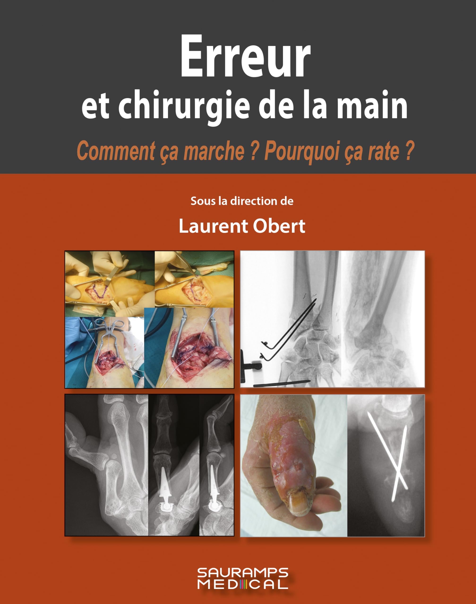 Erreur et chirurgie de la main book