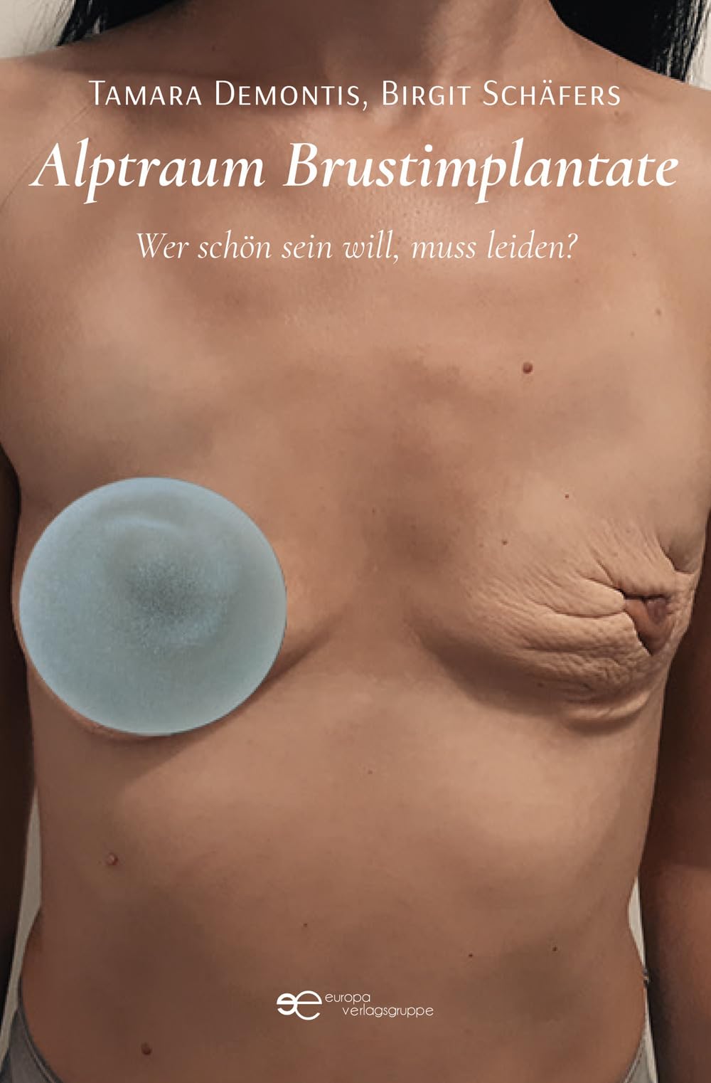 Product Image: ALPTRAUM BRUSTIMPLANTATE