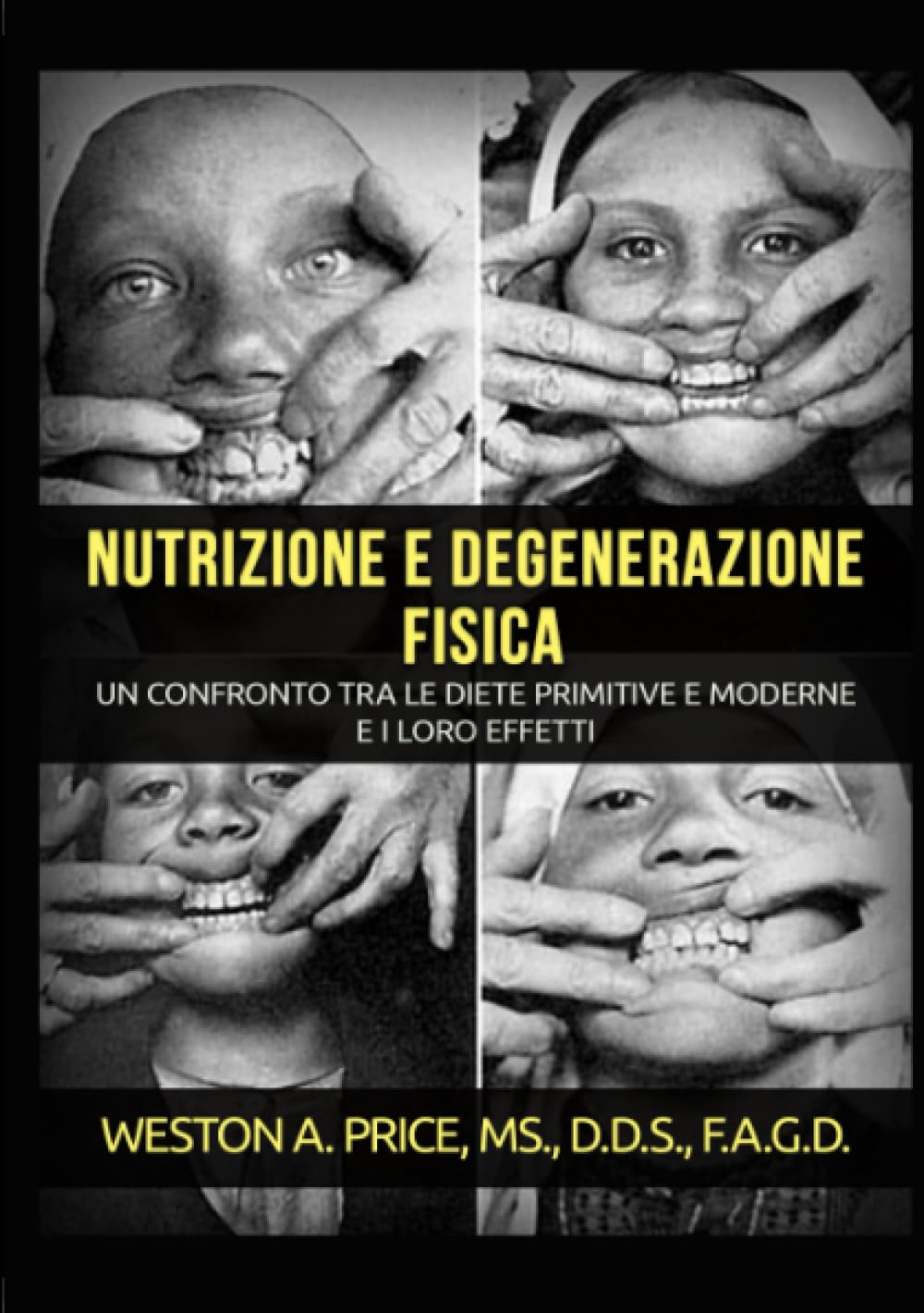 Nutrizione e degenerazione fisica Medicine