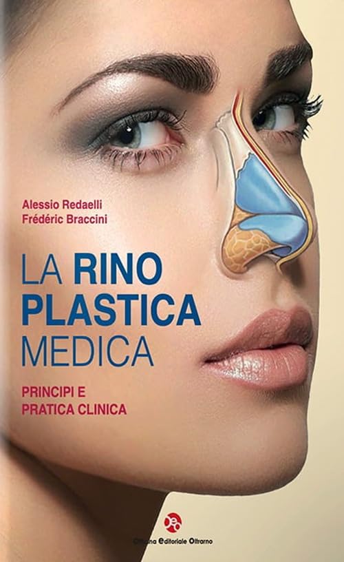 La rinoplastica medica. Principi e pratica clinica Medicine