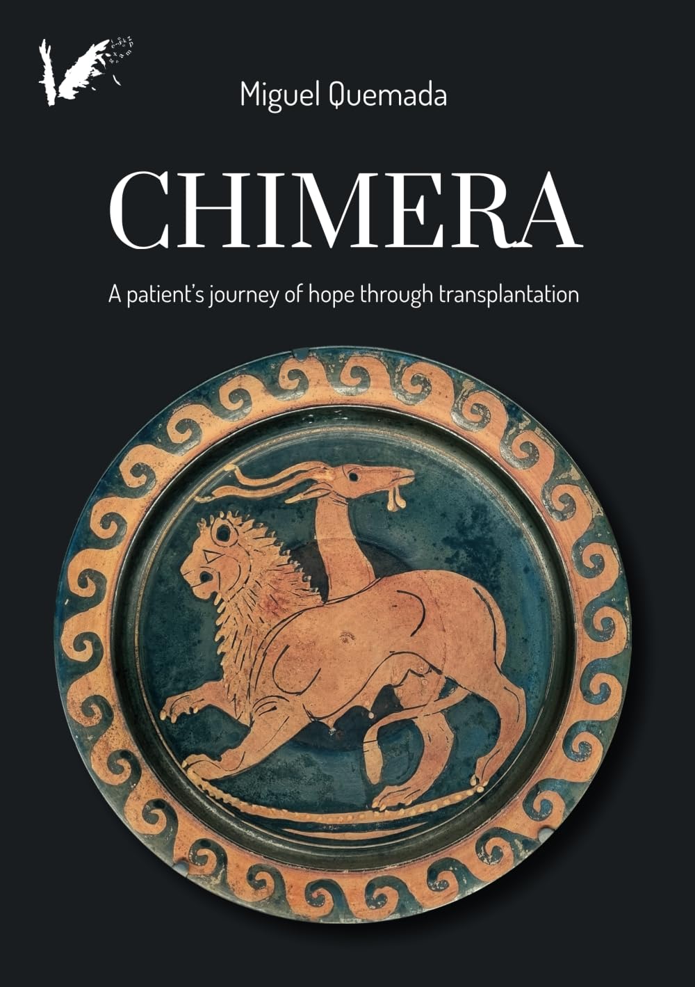 Chimera. A patient's journey of hope through transplantation Science