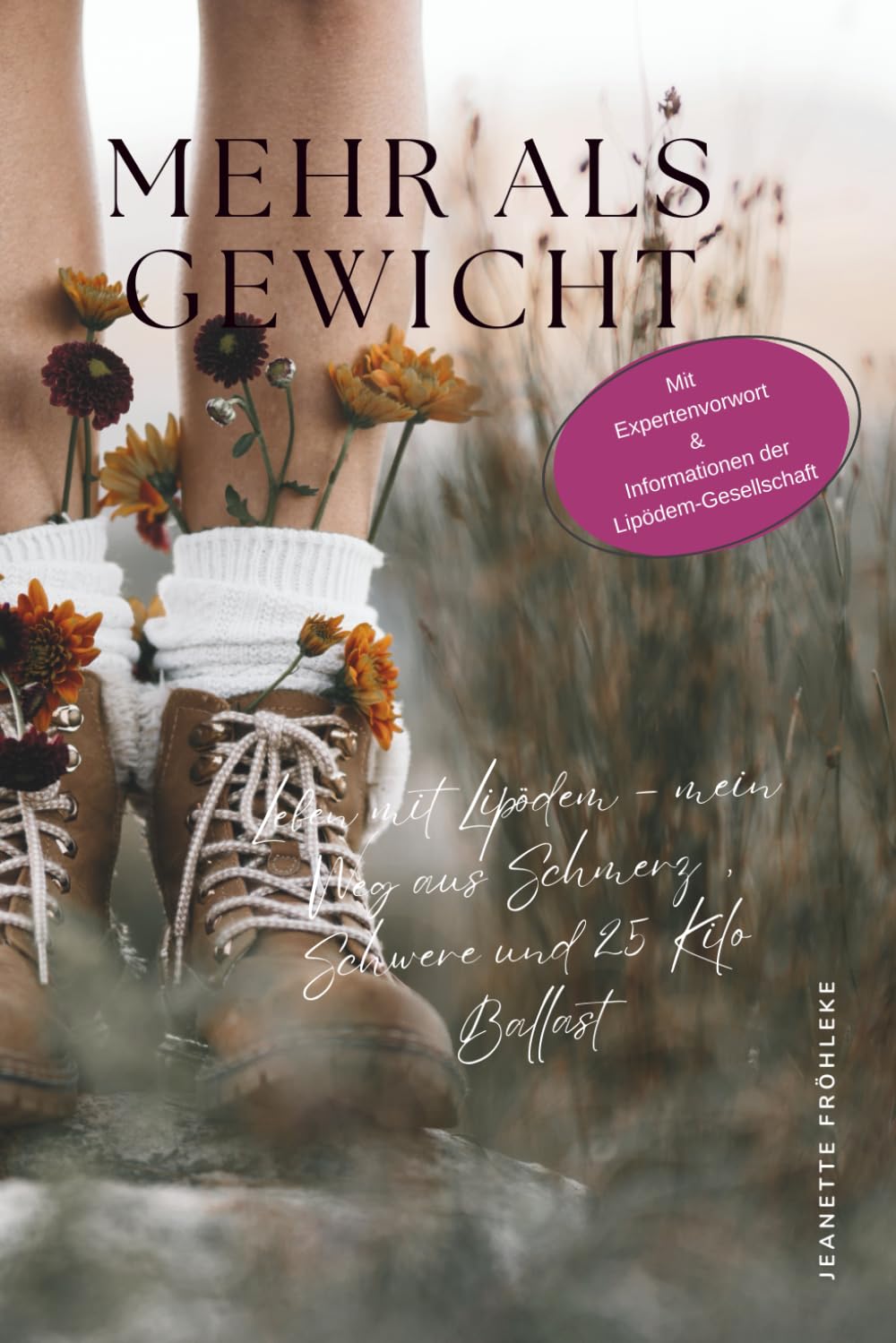 Mehr als Gewicht: Leben mit Lipödem – mein Weg aus Schmerz, Schwere und 25 Kilo Ballast Health, Nutrition & Fitness