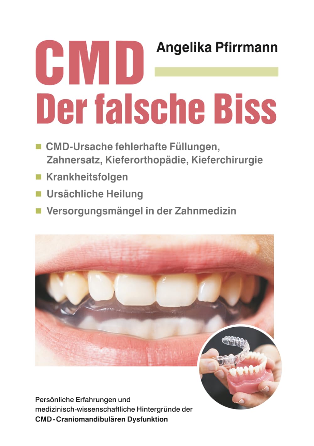 CMD Der falsche Biss: CMD-Ursache fehlerhafte Füllungen, Zahnersatz, Kieferorthopädie, Kieferchirurgie Krankheitsfolgen Ursächliche Heilung Versorgungsmängel in der Zahnmedizin Health, Nutrition & Fitness