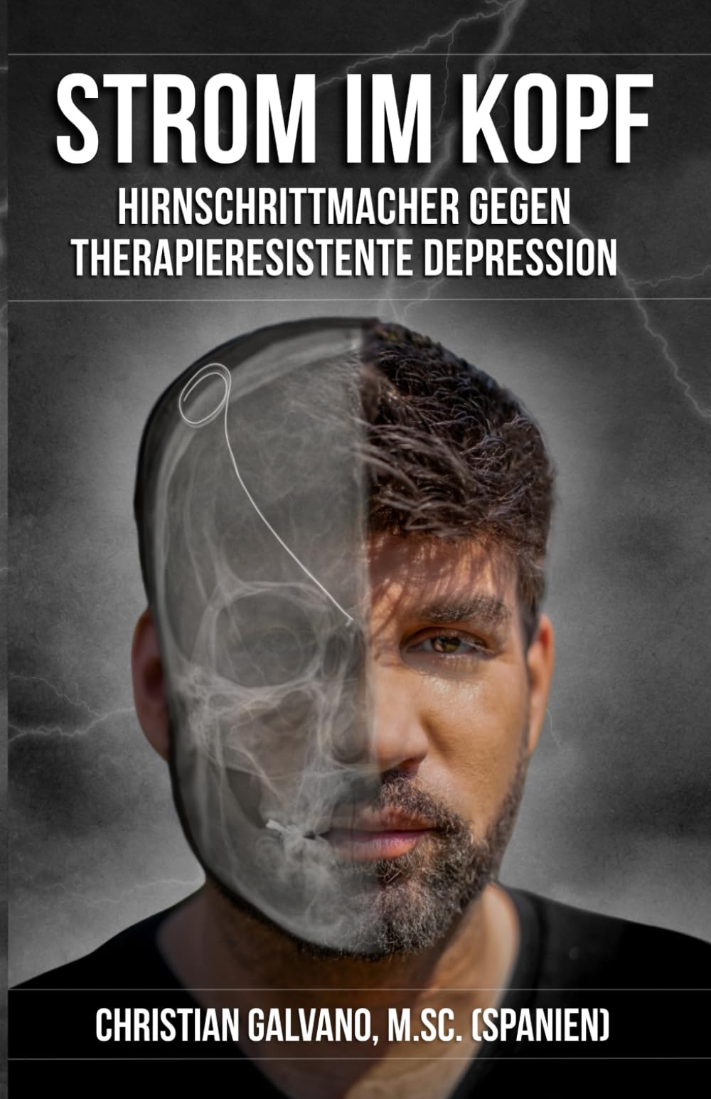 Strom im Kopf: Hirnschrittmacher gegen therapieresistente Depression Science