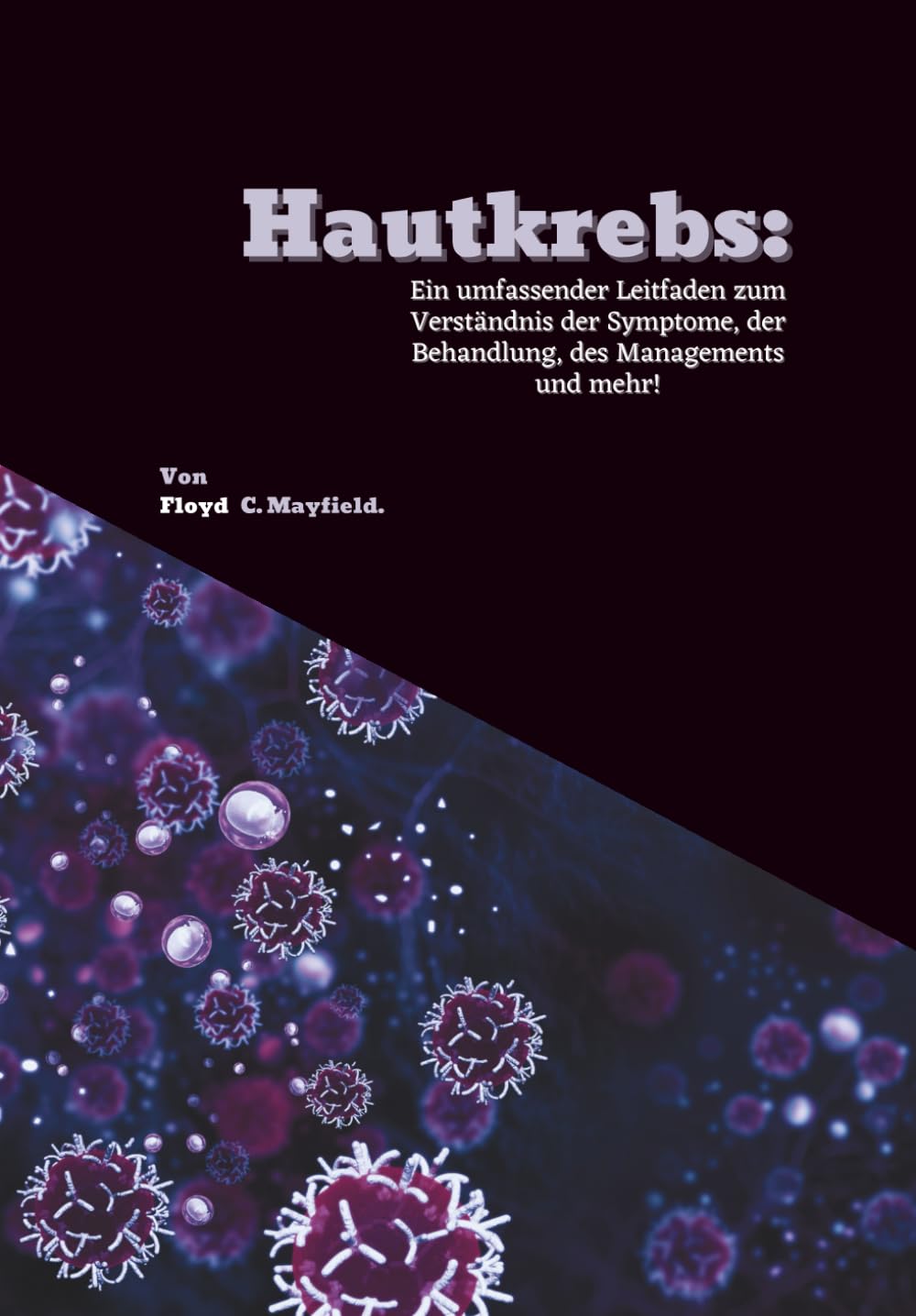 Hautkrebs: Ein umfassender Leitfaden zum Verständnis der Symptome, der Behandlung, des Managements und mehr! Medicine