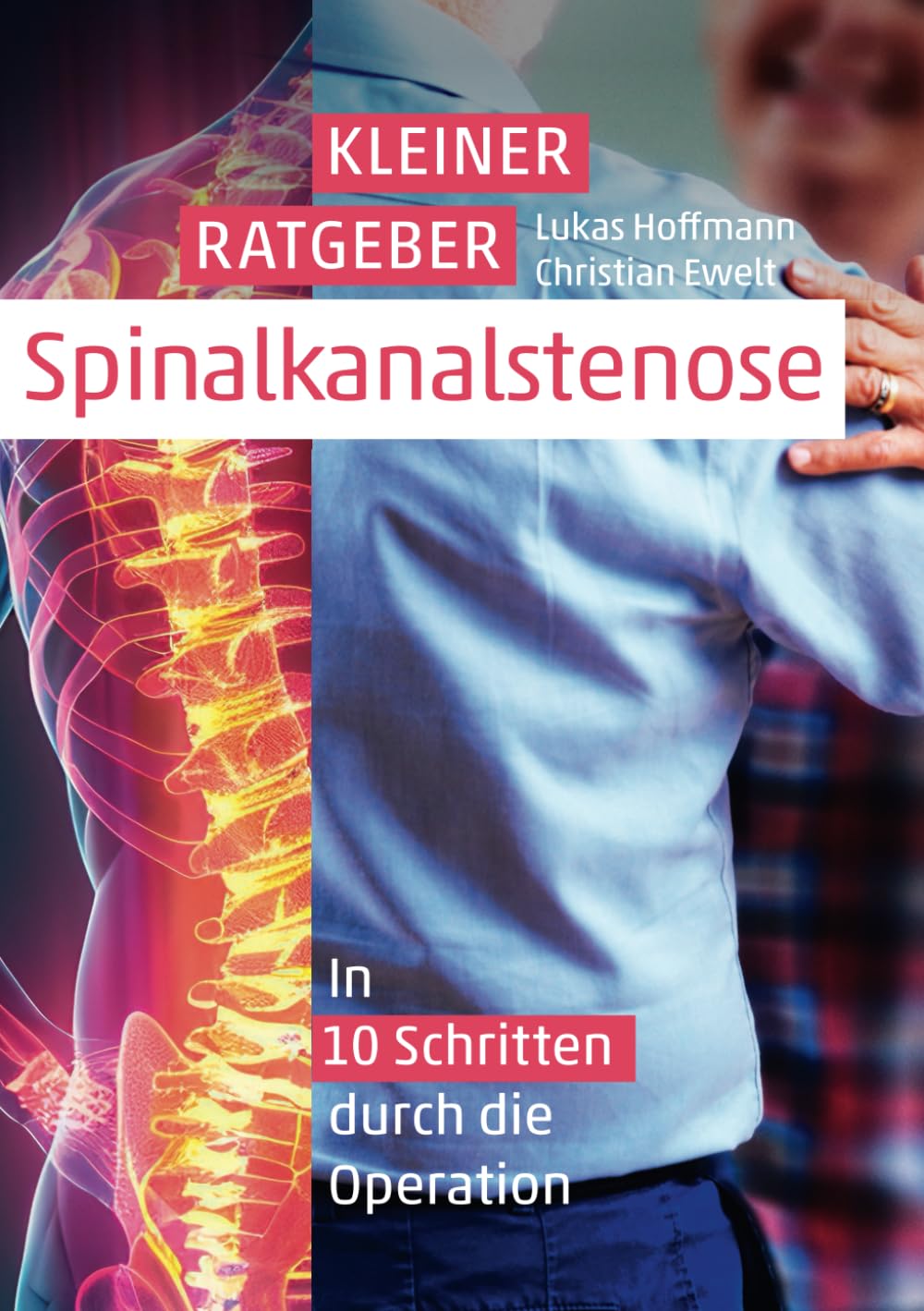 Kleiner Ratgeber Spinalkanalstenose: In 10 Schritten durch die Operation Medicine