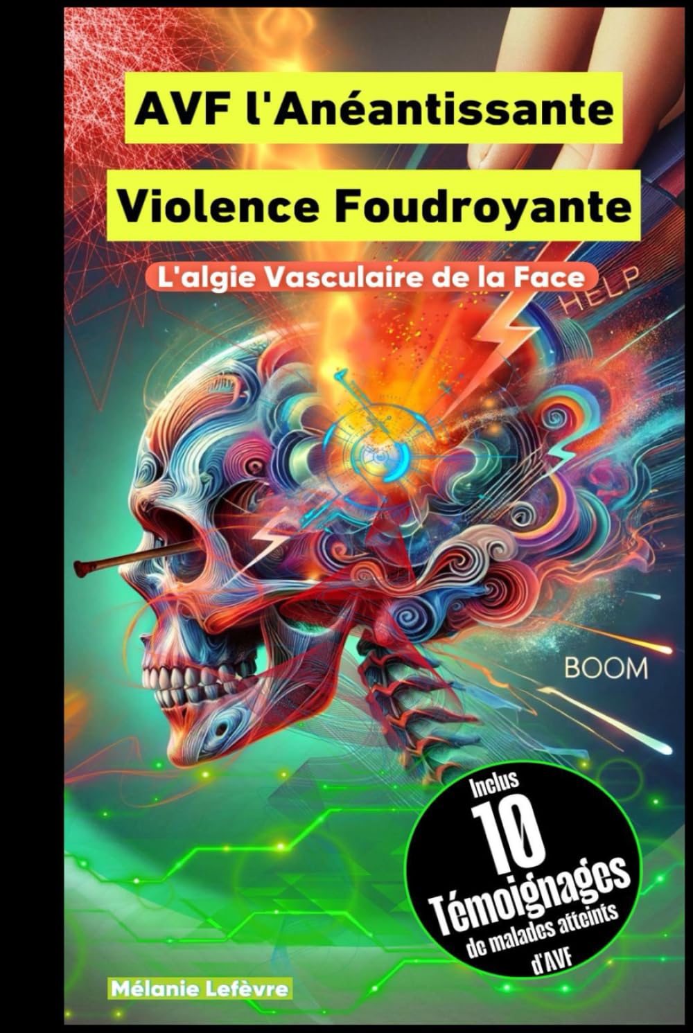 L'AVF l'Anéantissante Violence Foudroyante - L'algie Vasculaire de la Face book