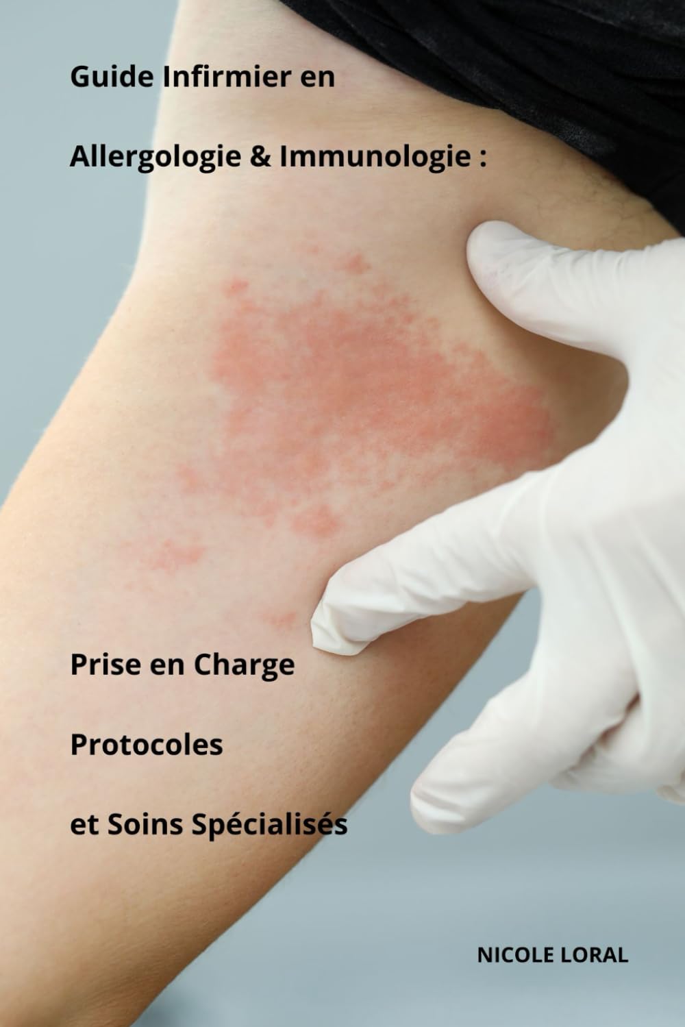 Guide Infirmier en Allergologie & Immunologie : Prise en Charge, Protocoles et Soins Spécialisés book
