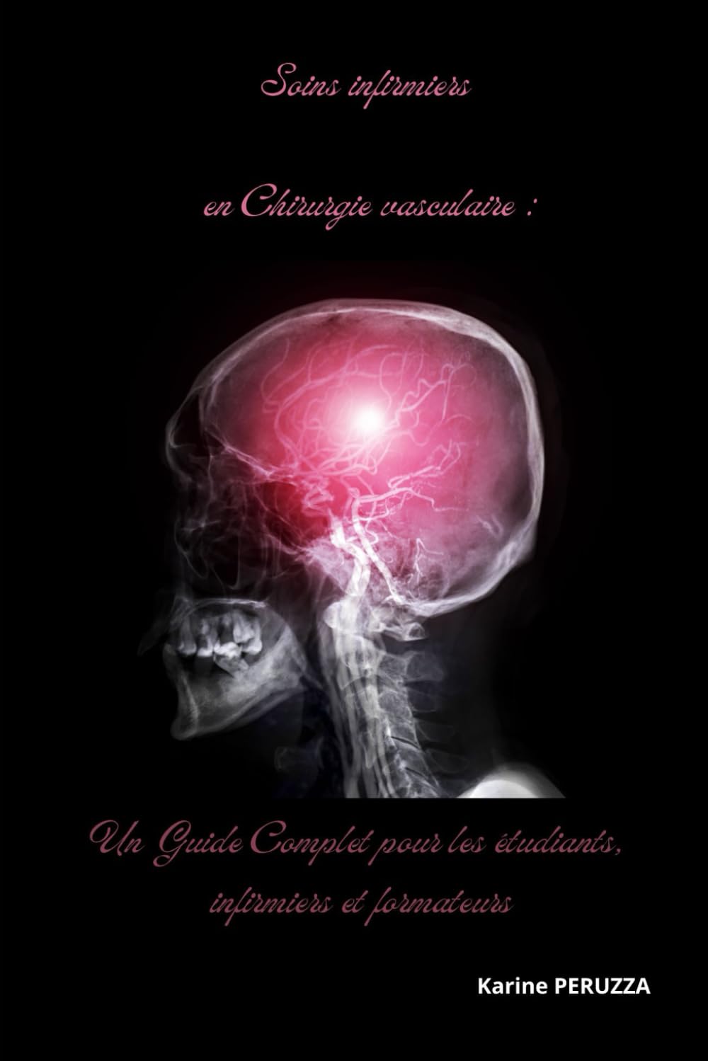 Soins infirmiers en Chirurgie vasculaire : Un Guide Complet pour les étudiants, infirmiers et formateurs book