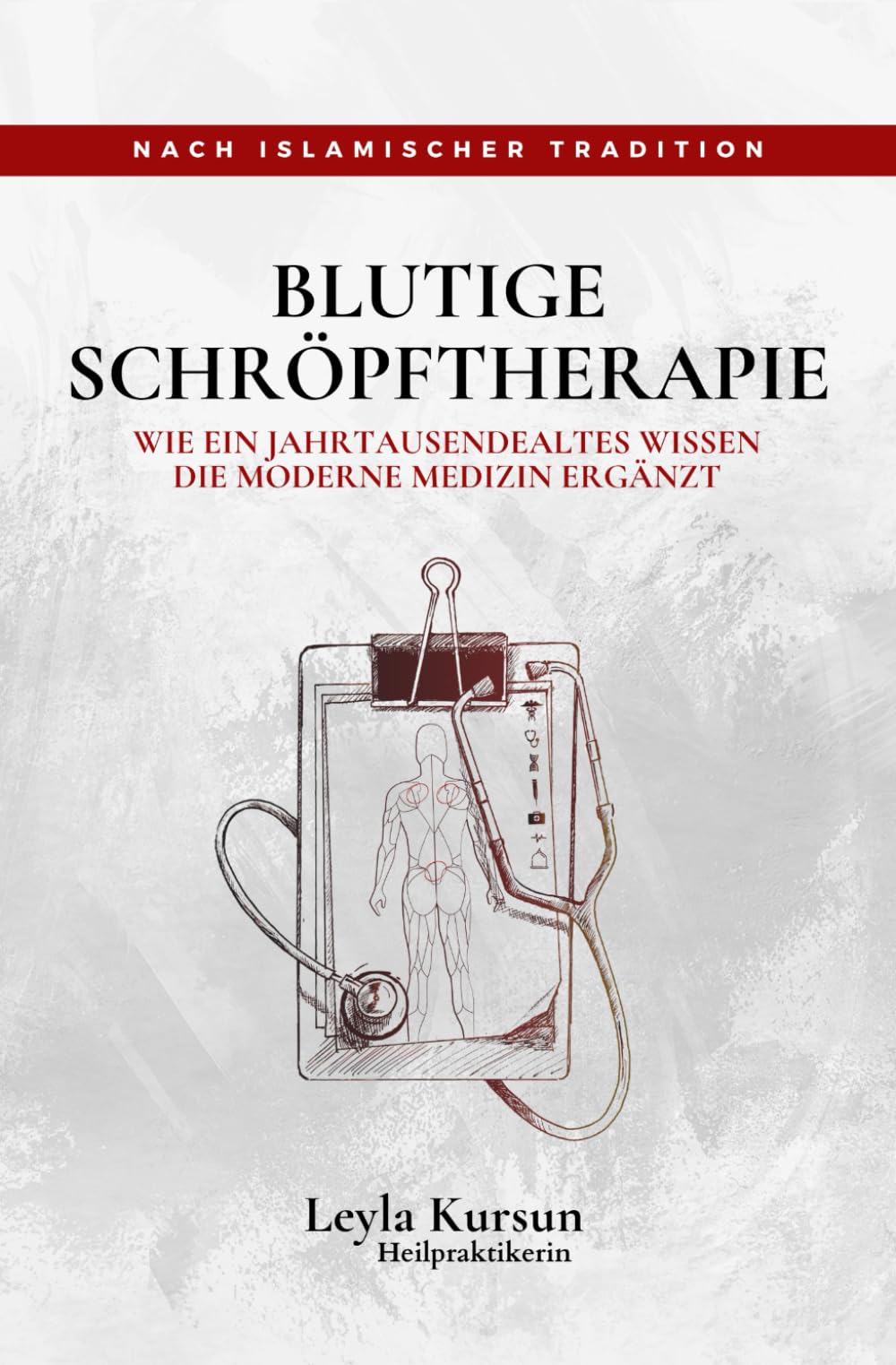 Blutige Schröpftherapie: Wie ein jahrtausendealtes Wissen die moderne Medizin ergänzt (Hijama, Hacamat) Health, Nutrition & Fitness