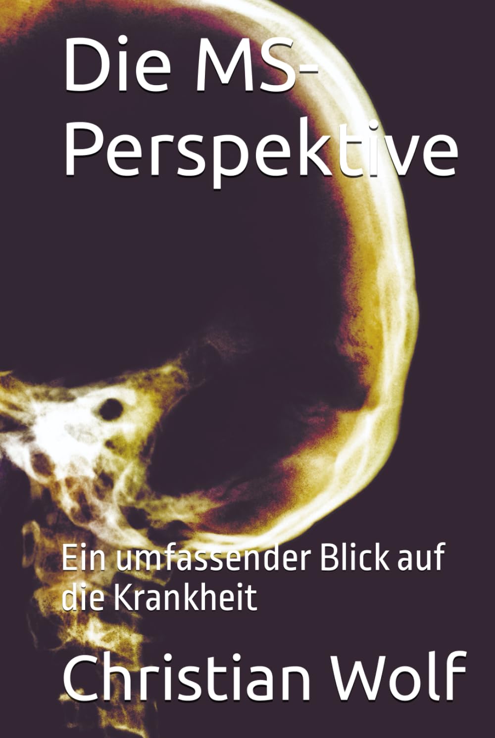 Die MS-Perspektive: Ein umfassender Blick auf die Krankheit Books