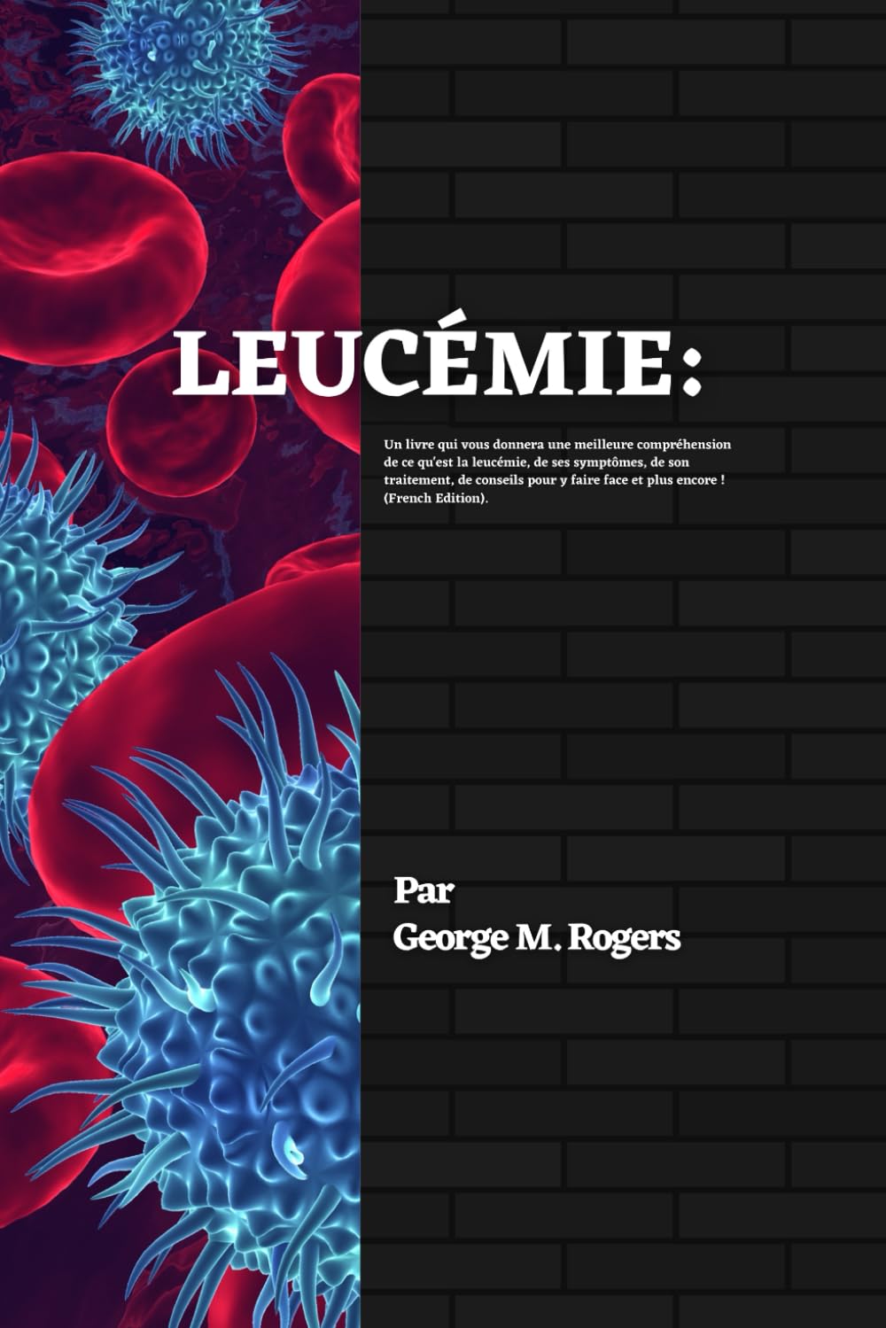 LEUCÉMIE: Un livre qui vous donnera une meilleure compréhension de ce qu'est la leucémie, de ses symptômes, de son traitement, de conseils pour y faire face et plus encore !(French Edition). book