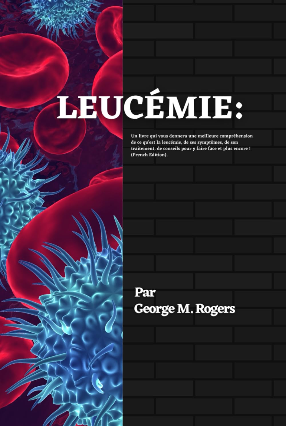 LEUCÉMIE: Un livre qui vous donnera une meilleure compréhension de ce qu'est la leucémie, de ses symptômes, de son traitement, de conseils pour y faire face et plus encore !(French Edition). book