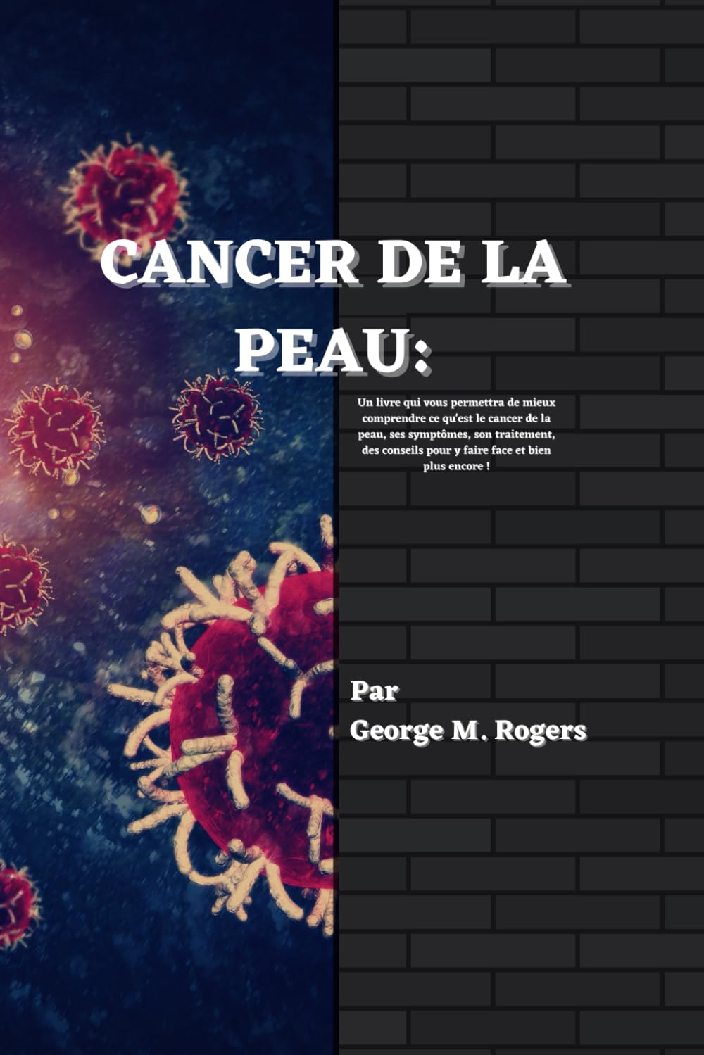 CANCER DE LA PEAU: Un livre qui vous permettra de mieux comprendre ce qu'est le cancer de la peau, ses symptômes, son traitement, des conseils pour y faire face et bien plus encore ! book