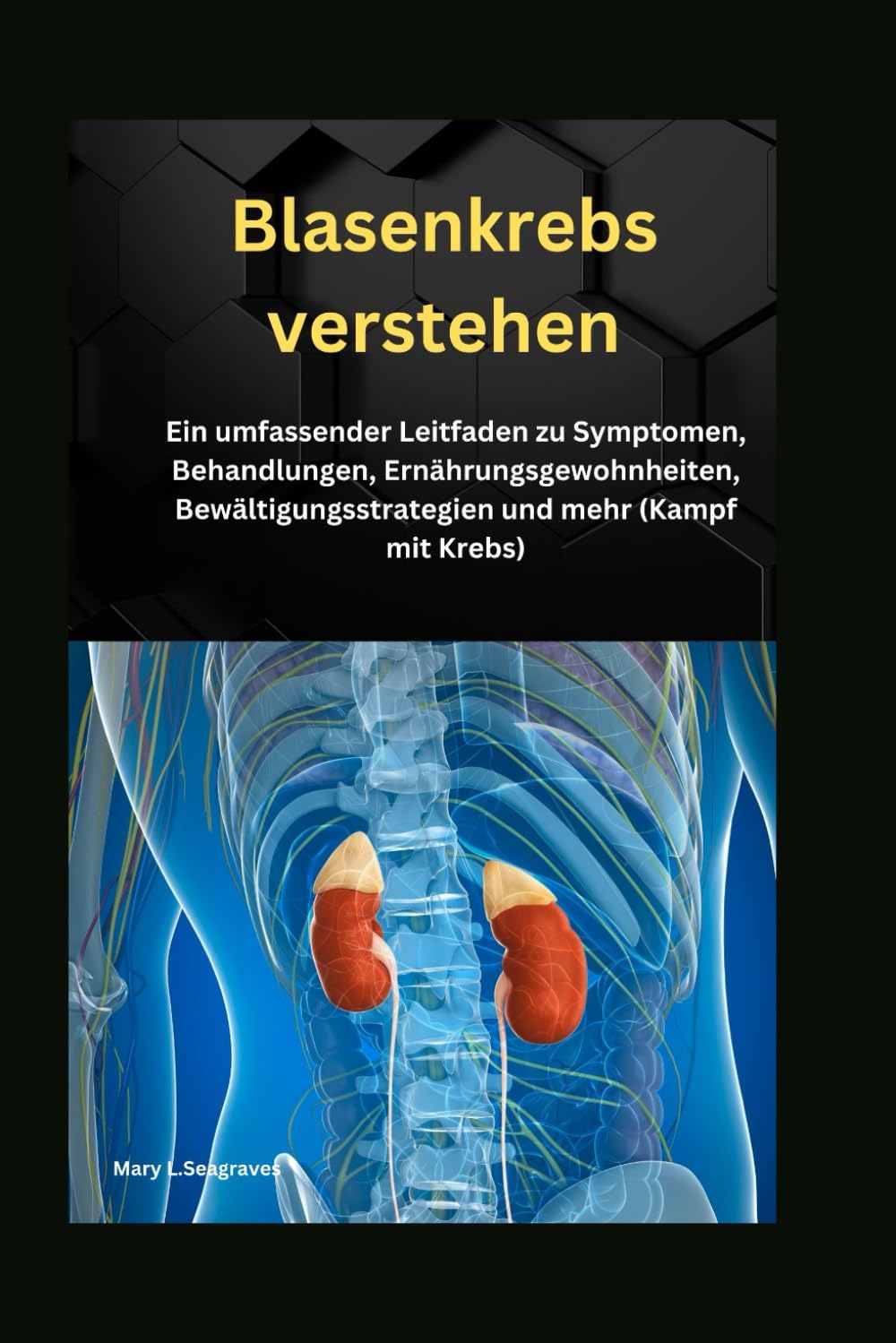 Blasenkrebs verstehen: Ein umfassender Leitfaden zu Symptomen, Behandlungen, Ernährungsgewohnheiten, Bewältigungsstrategien und mehr (Kampf mit Krebs) book