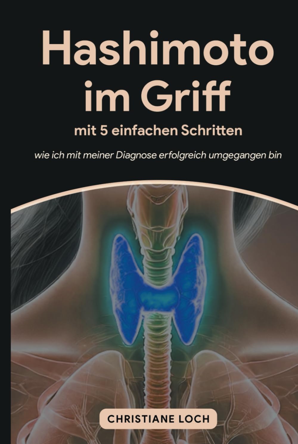 Hashimoto im Griff mit 5 einfachen Schritten: wie ich mit meiner Diagnose erfolgreich umgegangen bin Medicine