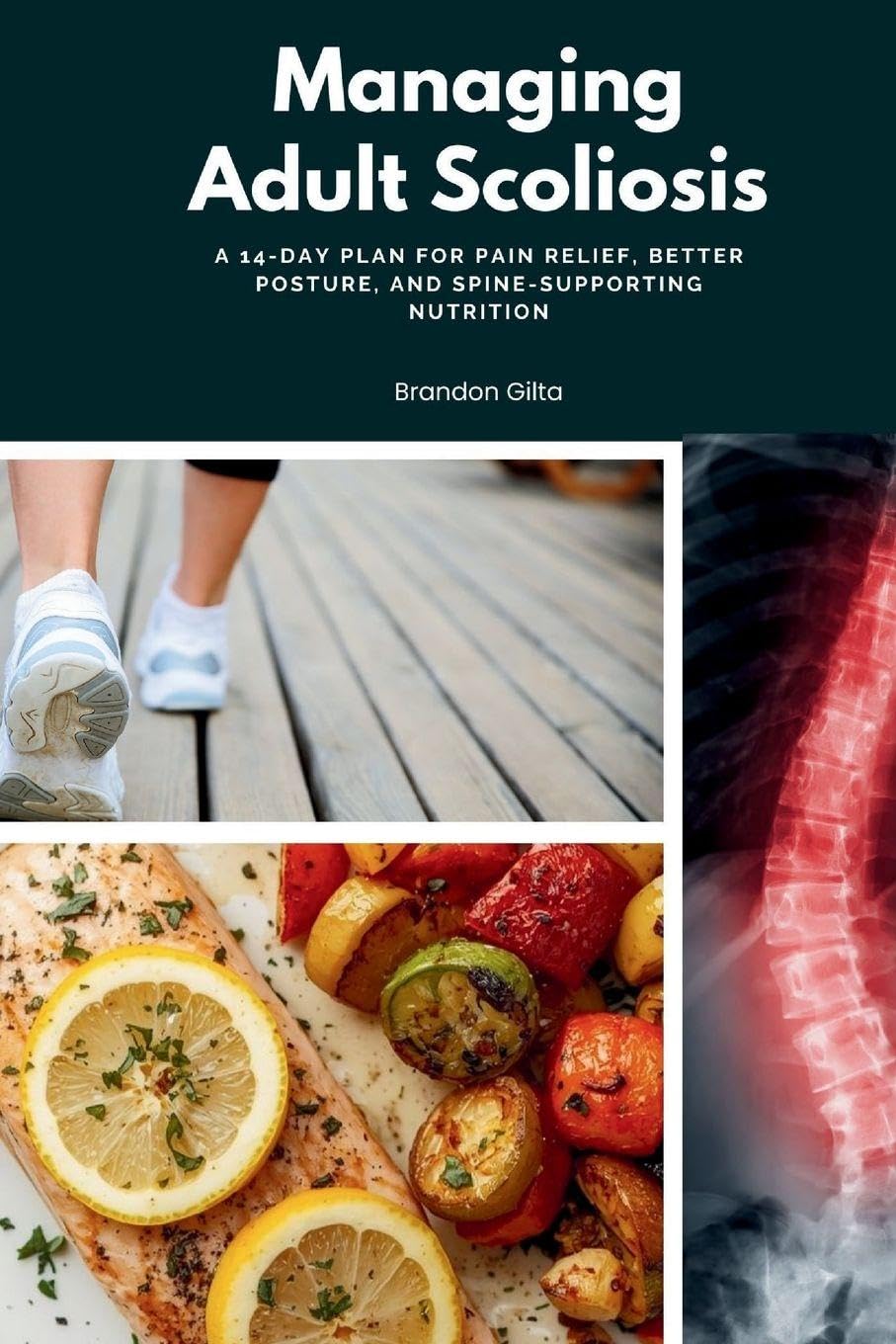 Managing Adult Scoliosis Health, Nutrition & Fitness