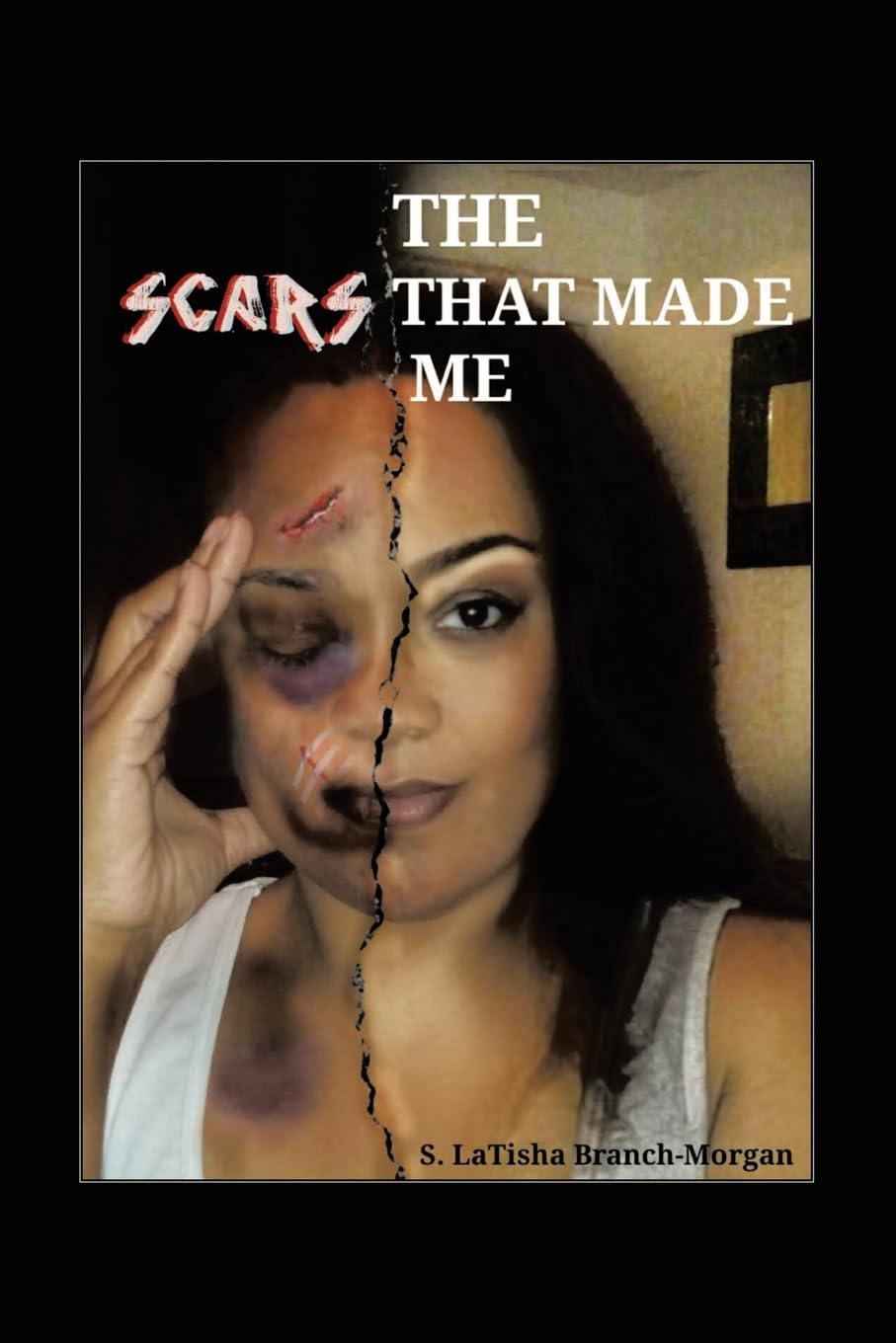 THE SCARS THAT MADE ME Health, Nutrition & Fitness