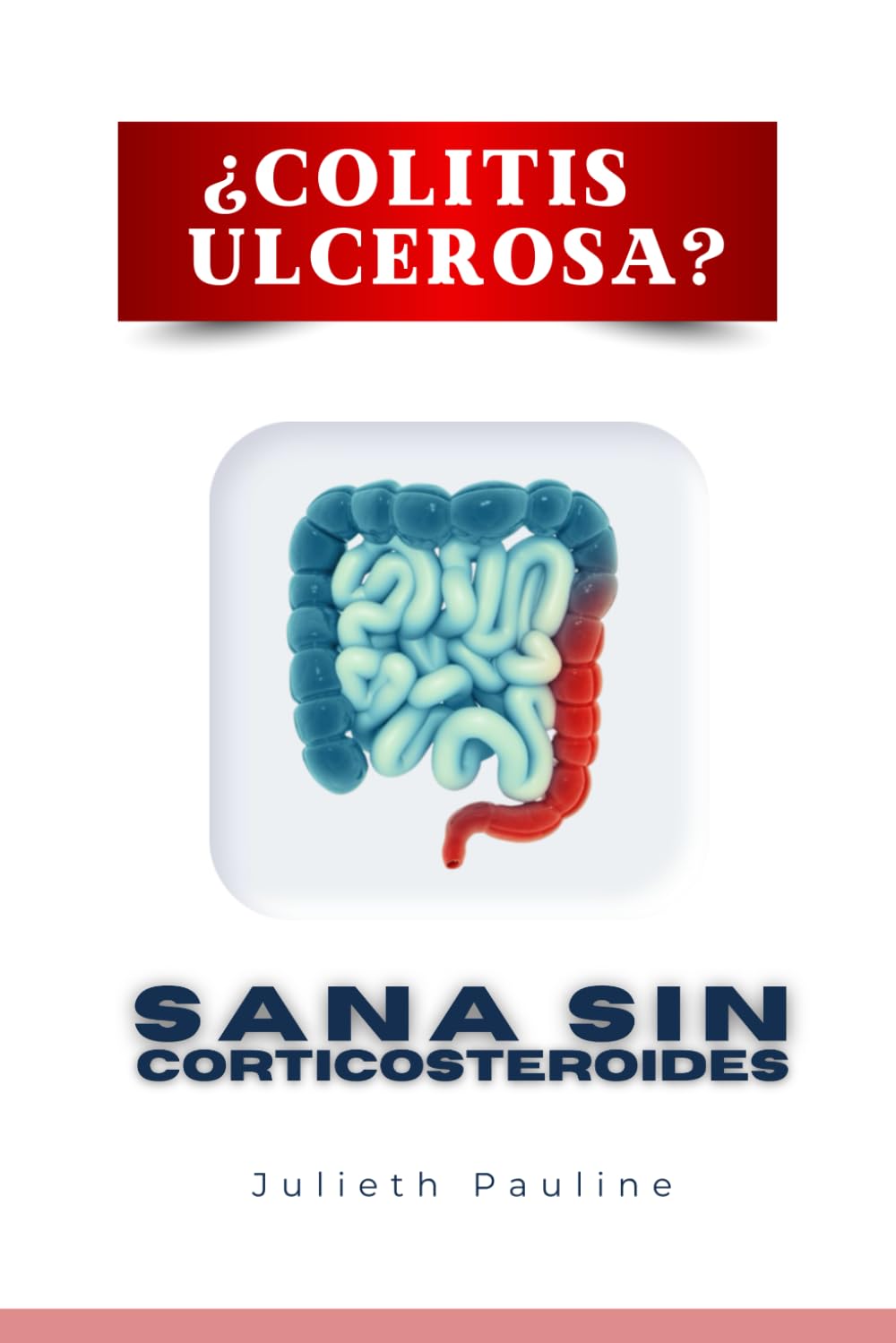¿COLITIS ULCEROSA?: ¡Sana Sin Corticosteroides! book