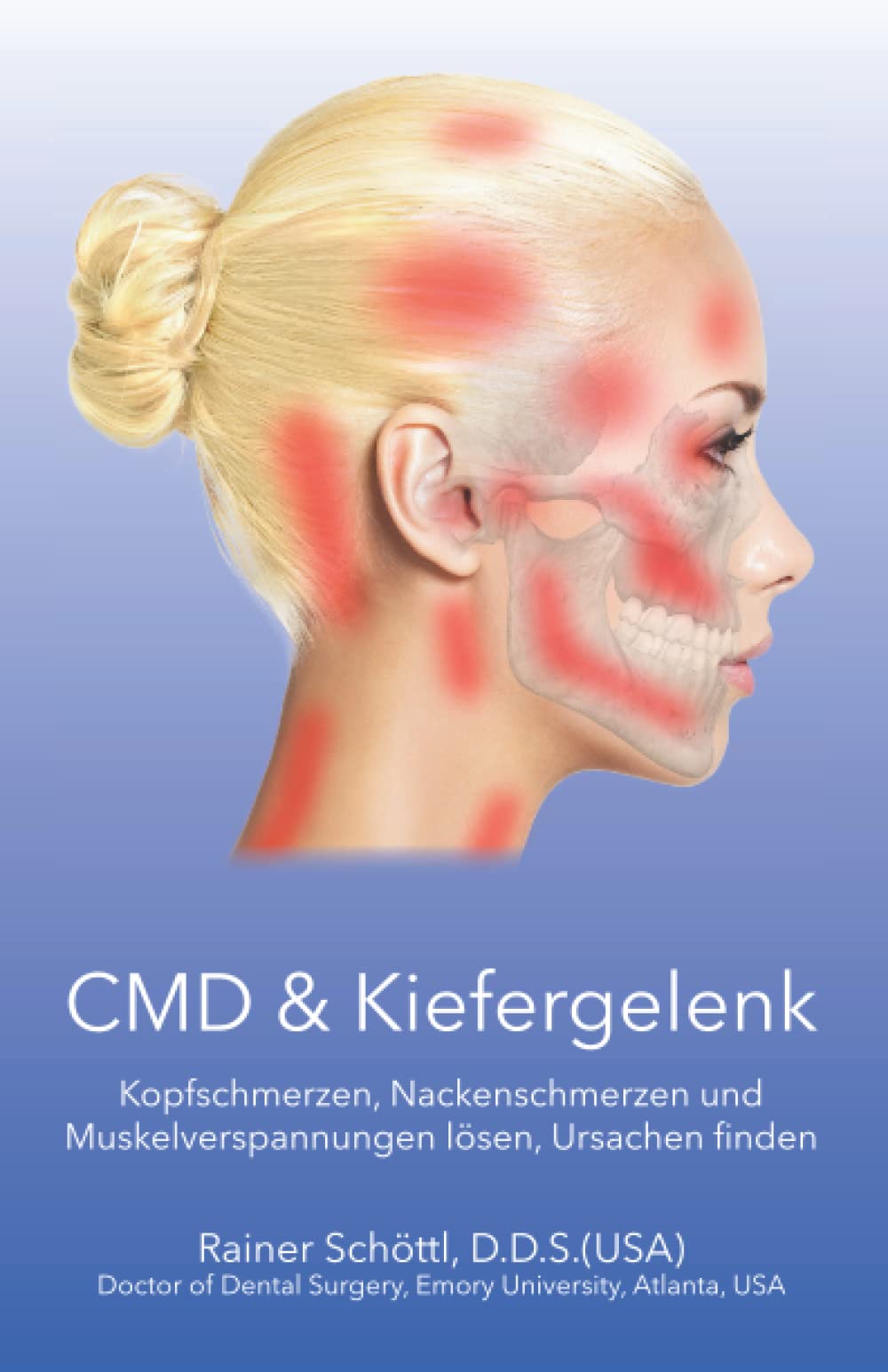 CMD & Kiefergelenk: Kopfschmerzen, Nackenschmerzen und Muskelverspannungen lösen, Ursachen finden Health, Nutrition & Fitness