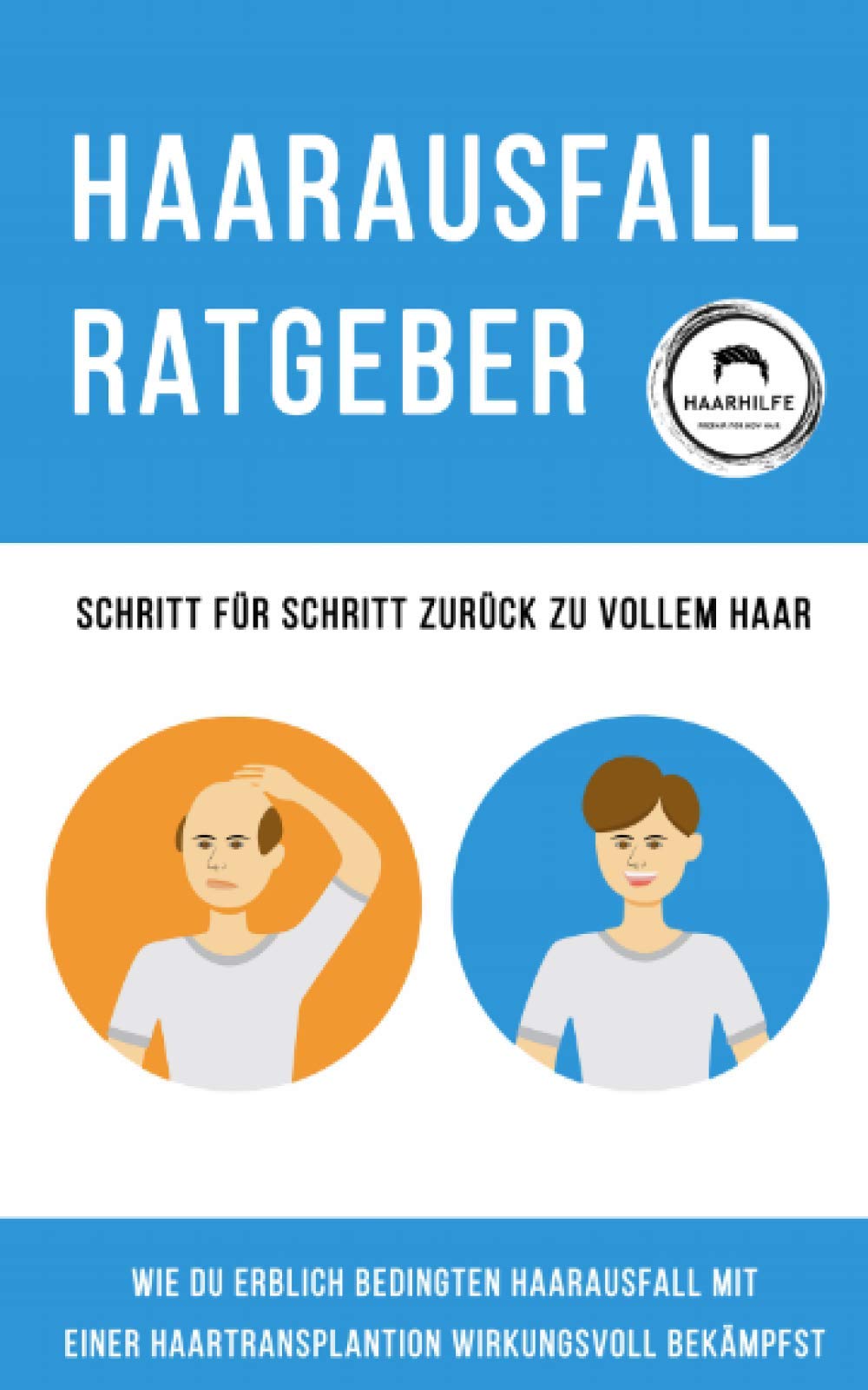 Haarausfall Ratgeber - Schritt für Schritt zurück zu vollem Haar: Wie du erblich bedingten Haarausfall mit einer Haartransplantation wirkungsvoll bekämpfst Medicine
