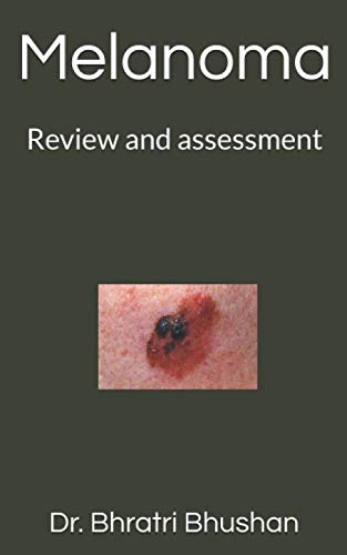Melanoma: Review and assessment Medicine