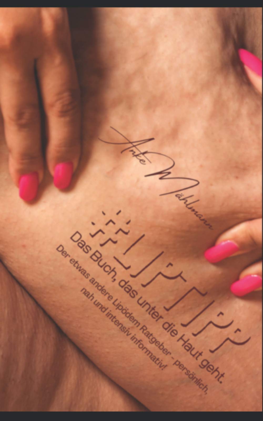 #LIPTIPP: Das Buch, das unter die Haut geht. Der etwas andere Lipödem Ratgeber - Persönlich, nah und intensiv informativ! Medicine