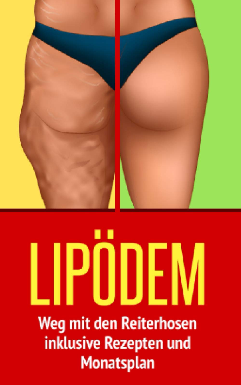 LIPÖDEM: Weg mit den Reiterhosen - inklusive Rezepten und Monatsplan Health, Nutrition & Fitness
