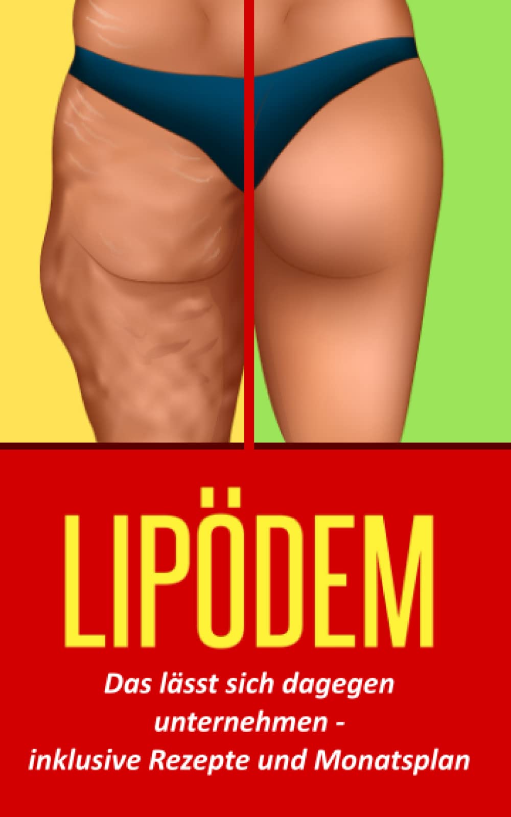 LIPÖDEM: Das lässt sich dagegen unternehmen - inklusive Rezepte und Monatsplan Health, Nutrition & Fitness