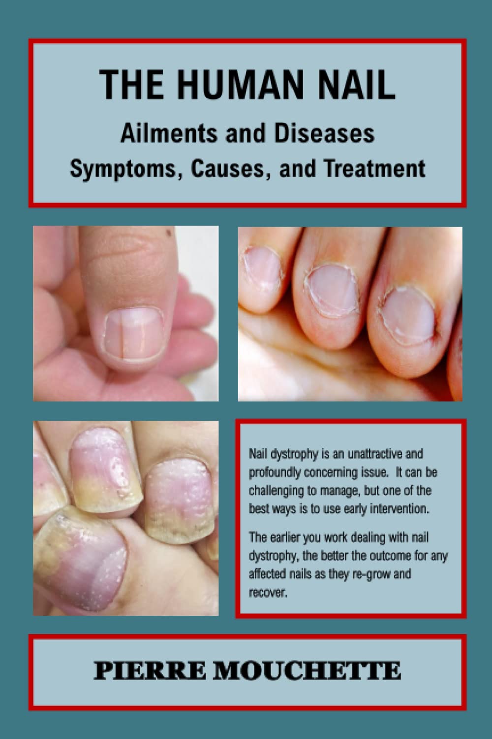 THE HUMAN NAIL - Ailments and Diseases: Symptoms, Causes, and Treatment Medicine