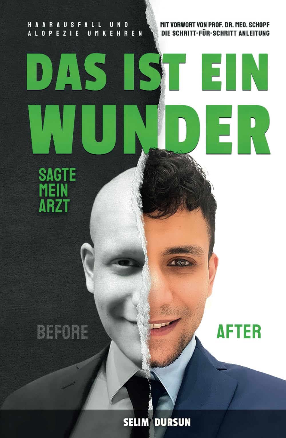 DAS IST EIN WUNDER SAGTE MEIN ARZT: HAARVERLUST UND ALOPEZIE UMKEHREN Health, Nutrition & Fitness